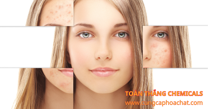 citric acid làm đẹp trong mỹ phẩm